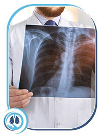 TB Treatment Specialist Near Me in Aventura FL