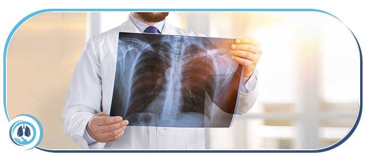Pulmonary Tuberculosis Doctor Near Me in Aventura FL Pulmonary Tuberculosis Doctor Near Me in Aventura FL
