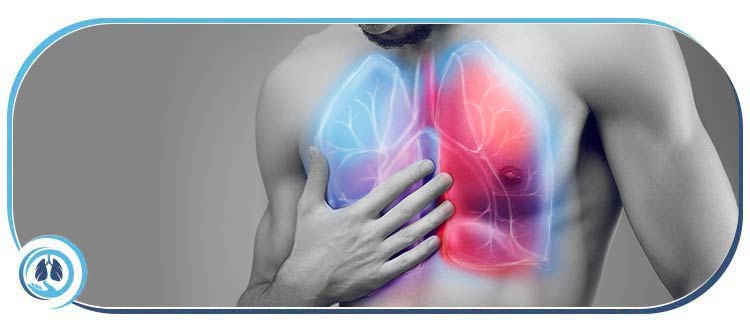 Acute Respiratory Distress Syndrome (ARDS) Treatment Specialist Near Me in Aventura FL Acute Respiratory Distress Syndrome (ARDS) Treatment Specialist Near Me in Aventura FL