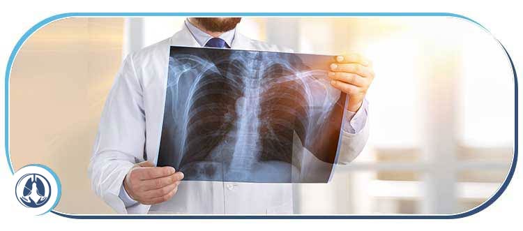 Tuberculosis (TB) Treatment Specialist Near Me in Hallandale Beach, FL