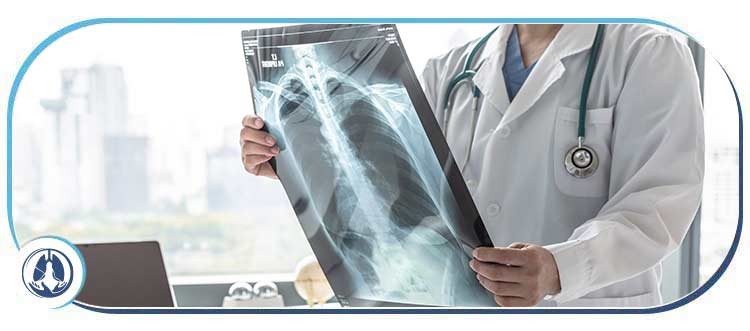 Pulmonary Tuberculosis Doctor Near Me in Hallandale Beach, FL