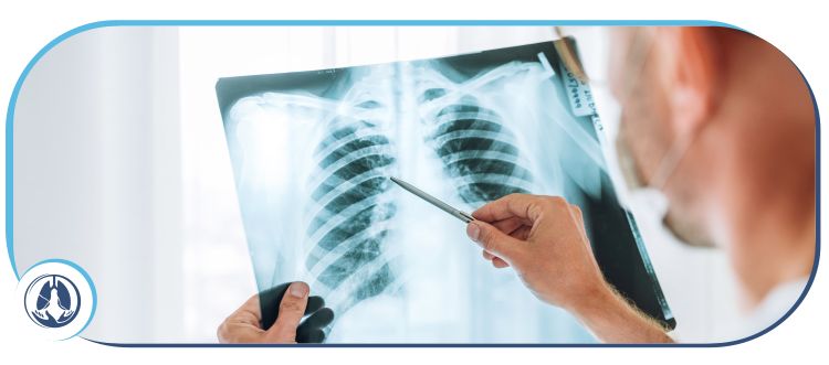 When to See a Lung Doctor in Hallandale Beach, FL When to See a Lung Doctor in Hallandale Beach, FL